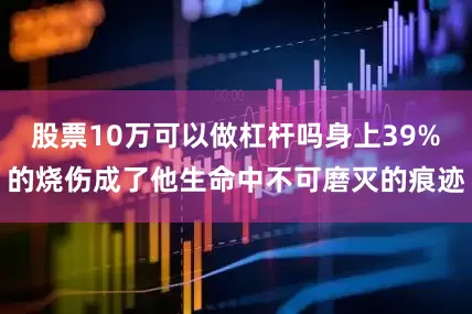 股票10万可以做杠杆吗身上39%的烧伤成了他生命中不可磨灭的痕迹